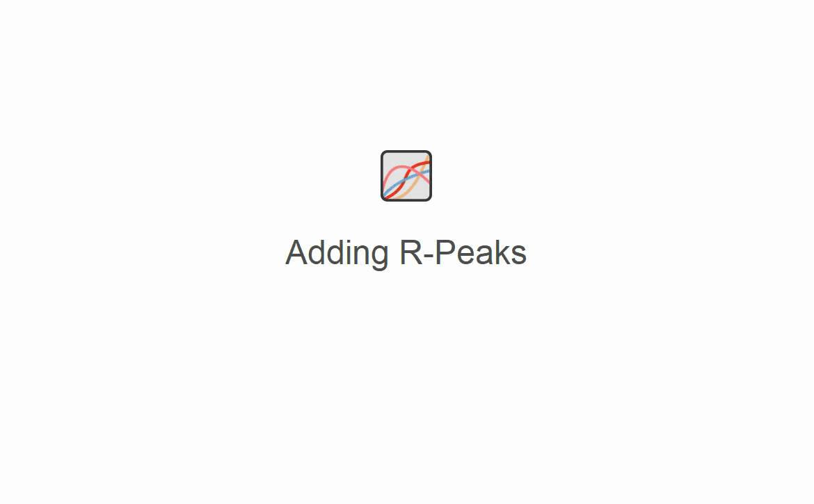 Adding and removing R-Peaks