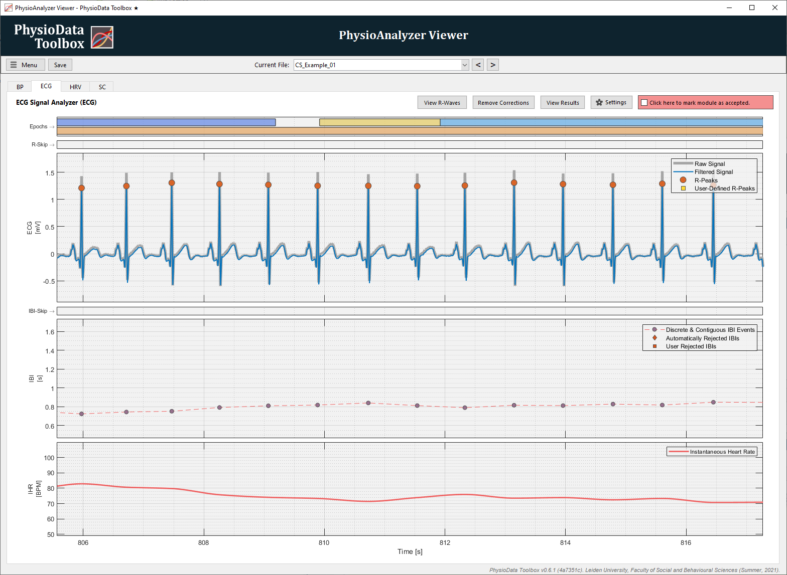PhysioAnalyzer Viewer