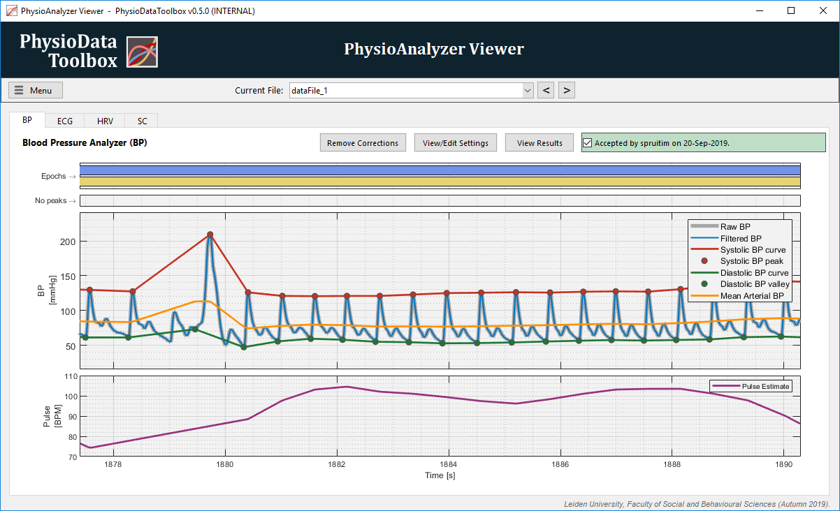 Blood Pressure analyzer artifact correction 1