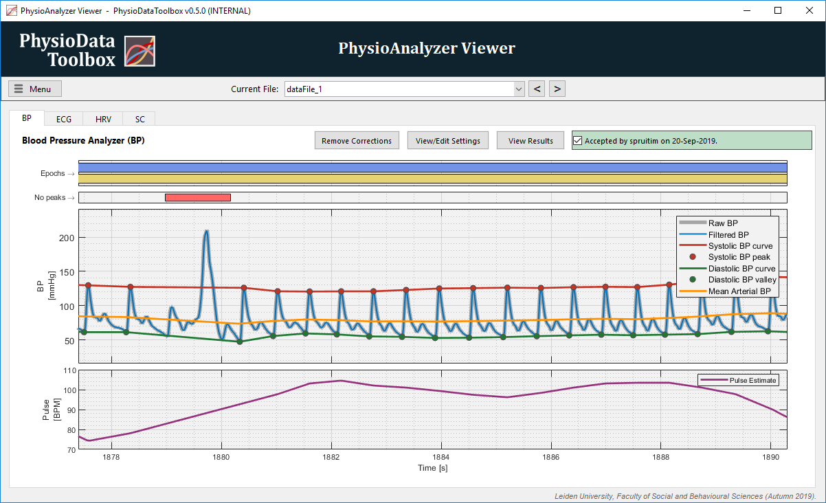 Blood Pressure analyzer artifact correction 3